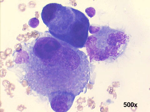 500x M-G-G staining, variability in cell morphology, anisonucleosis