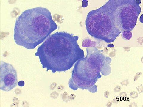 500x M-G-G staining, gaps between the cells, in the inset one cell clasping another