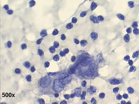 500x Papanicolaou staining