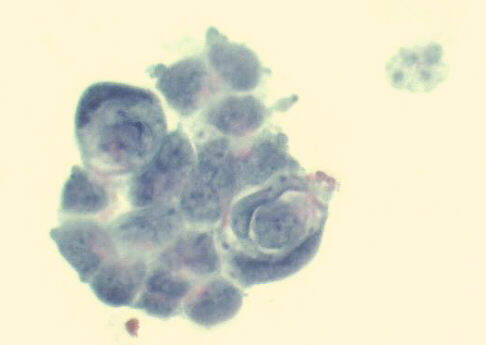500x Papanicolaou staining