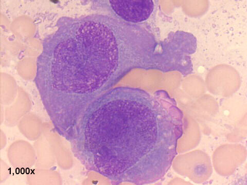 M-G-G staining 1,000x