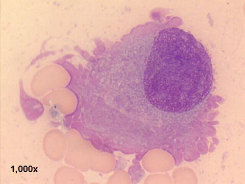M-G-G staining 1,000x