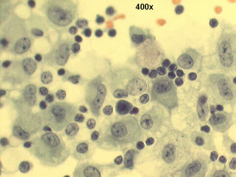 Papanicolaou staining