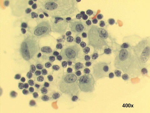 Papanicolaou staining