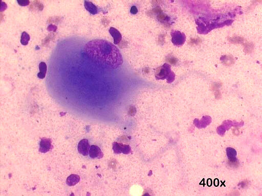 May-Gr�nwald-Giemsa 400x