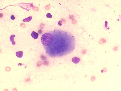 May-Gr�nwald-Giemsa 400x