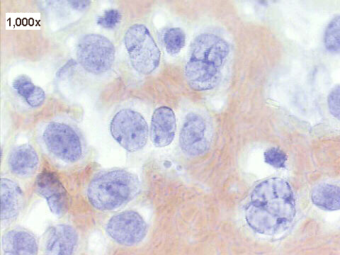 Papanicolaou staining, 1,000x