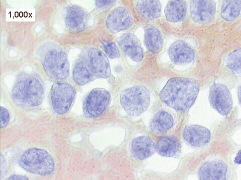 Papanicolaou staining, 1,000x