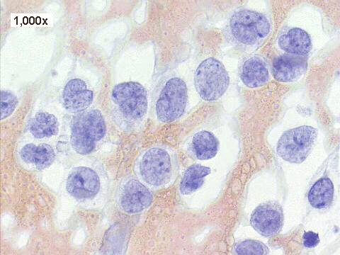 Papanicolaou staining, 1,000x