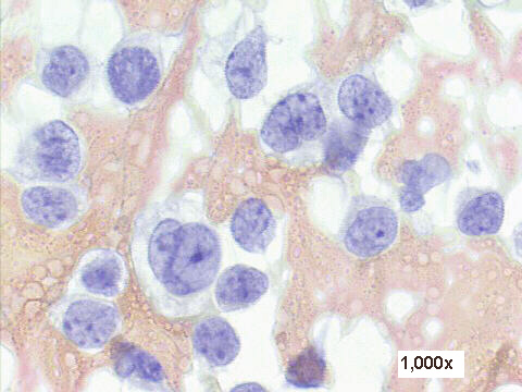 Papanicolaou staining, 1,000x