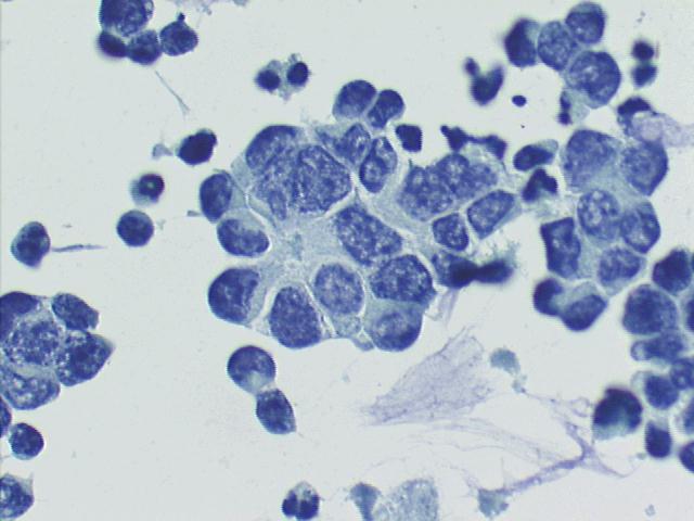 500x Pap staining