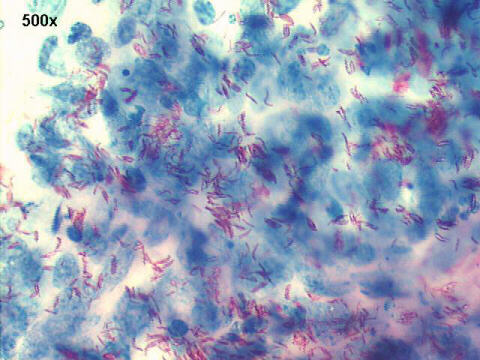 Ziehl-Neelsen staining, the rod-shaped bacteria are positively stained