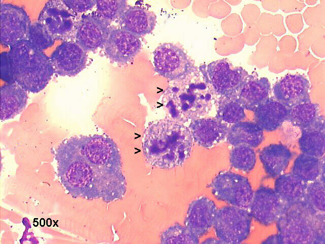 M-G-G staining 500x see apoptotic cells signaled by arrow heads