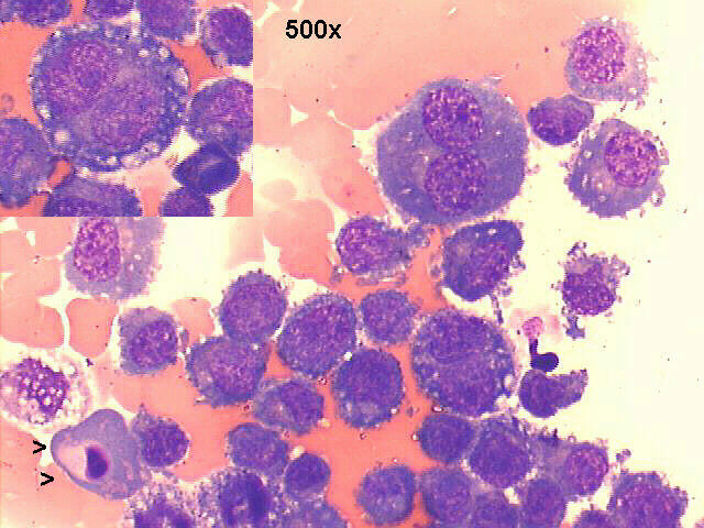 M-G-G staining 500x see apoptotic cell signaled by arrow heads