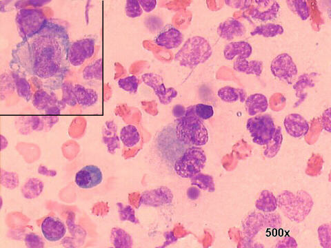 May-Gr�nwald-Giemsa staining