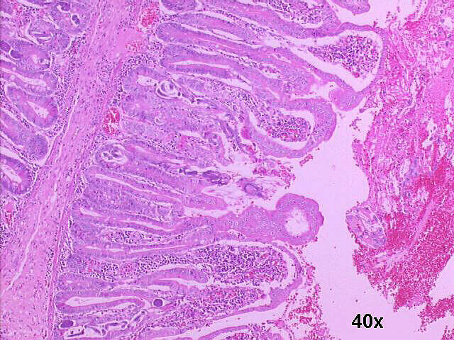 Photo 3 Small bowel resection specimen histology, H&E staining 40x