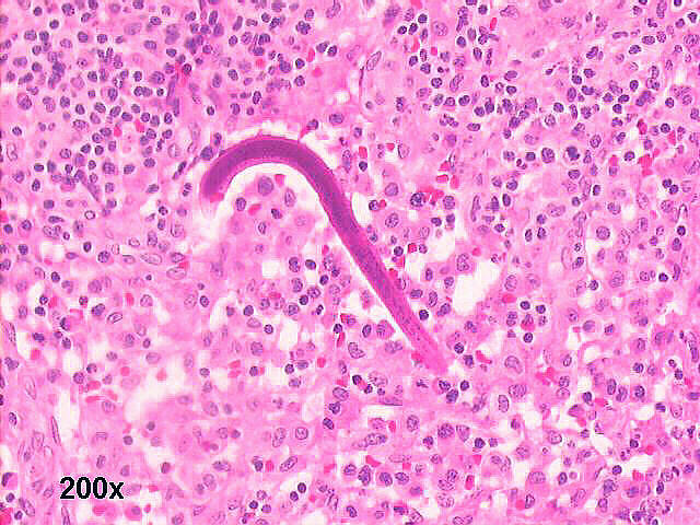 Photo 2 Lymph node histology H&E 200x