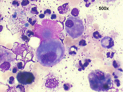 Typical anemone cell, 500x M-G-G staining