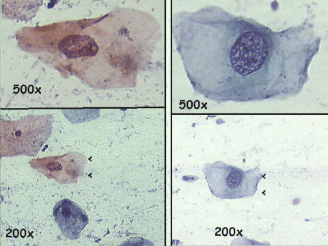 Papanicolaou staining