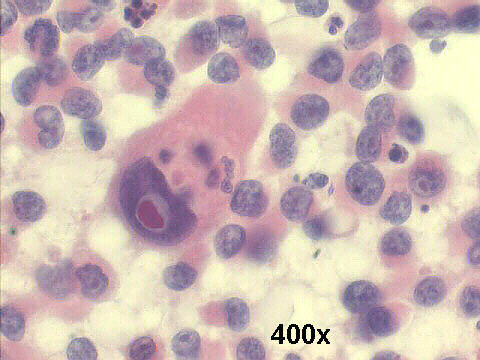 400x Papanicolaou staining