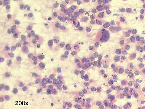 200x Papanicolaou staining