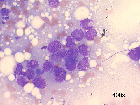 400x M-G-G  staining