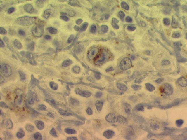 Cells CD15 positive 500x