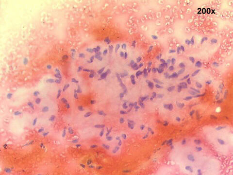200x Papanicolaou staining