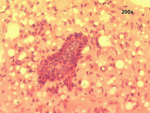 200x Papanicolaou staining