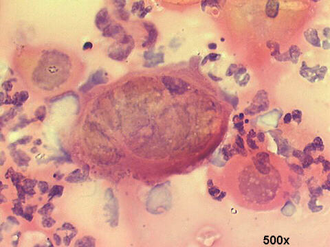 500x Papanicolaou staining