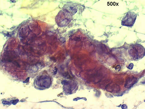500x Papanicolaou staining