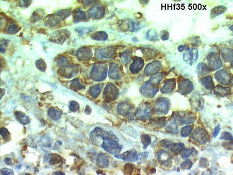 500x HHf35 positive staining