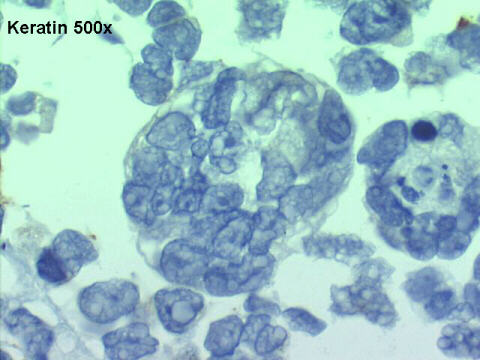 500x Keratin negative staining