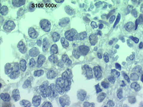 500x S100 negative staining