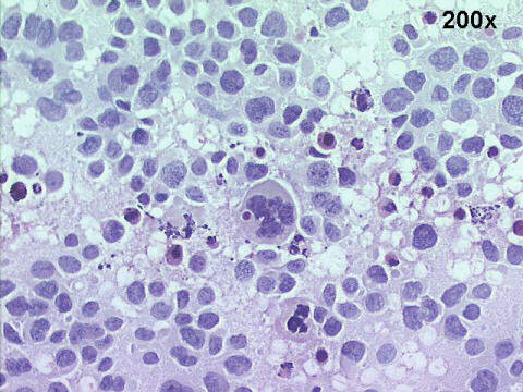 Papanicolaou staining