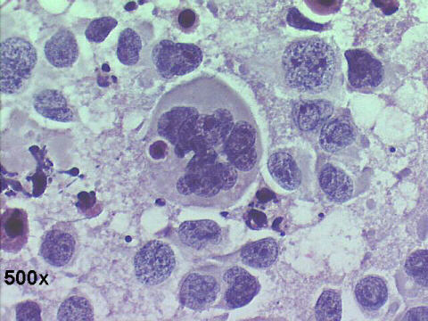 Papanicolaou staining