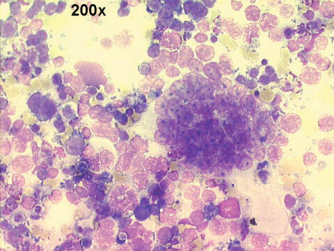 M-G-G staining