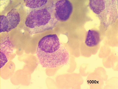 1000x M-G-G staining, pink cytoplasmic granules