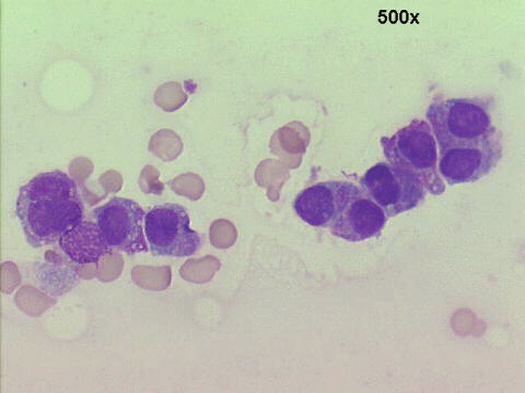 500x M-G-G staining, oval shaped cells with pink cytoplasmic granules