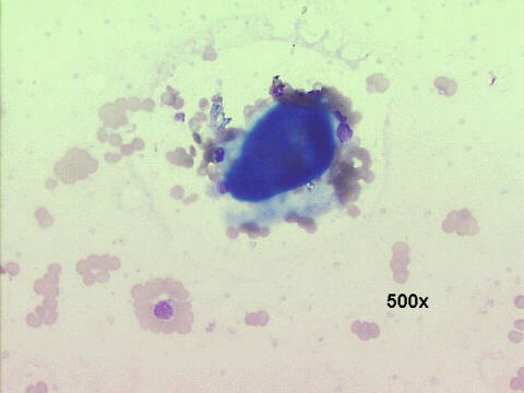 500x M-G-G staining