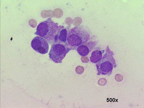 500x M-G-G staining, cytoplasmic pink granules