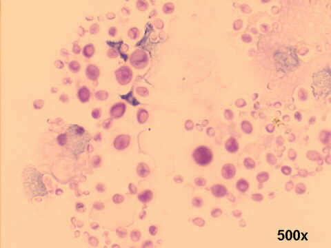 500x Papanicolaou staining, notice the unstained clear halos around the organisms