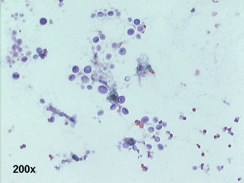 200x Papanicolaou staining