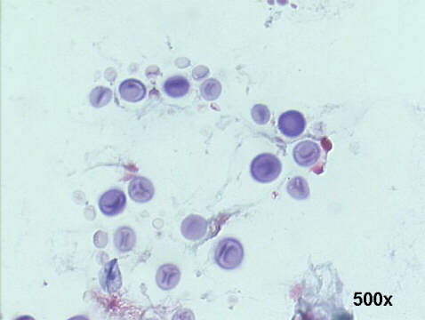 500x Papanicolaou staining, notice the unstained clear halos around the organisms