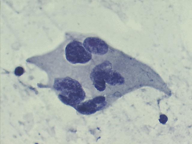 500x Papanicolaou staining