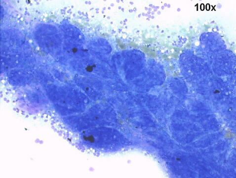 100x M-G-G staining