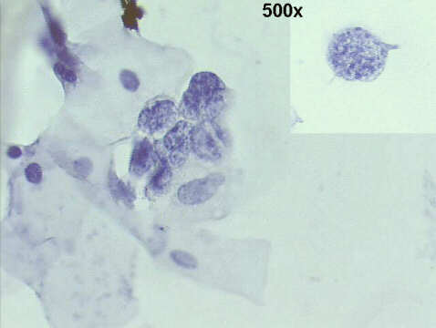 500x Papanicolaou staining