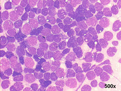 500x M-G-G, little variation in size and shape of lymphocytes
