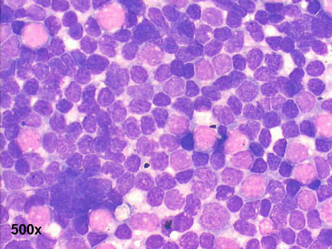 500x M-G-G staining, most of the cells are small mature looking lymphocytes