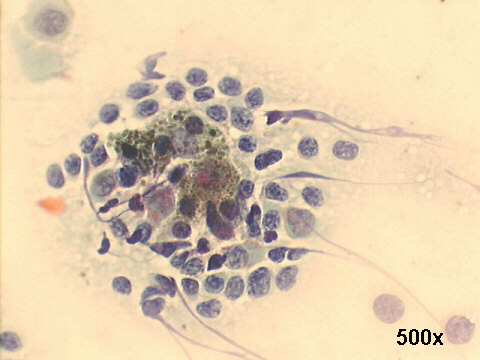 500x oil Papanicolaou staining